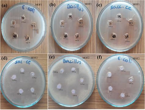 Estimation of antibacterial and antimicrobial activity by Agar plate... | Download Scientific ...