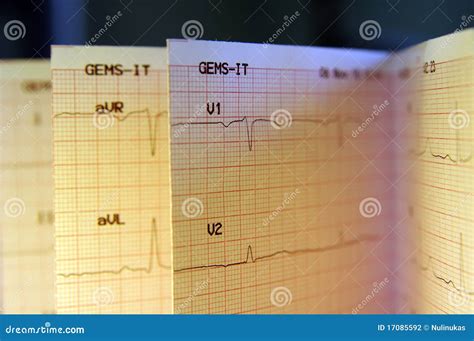 Cardiogram stock photo. Image of examination, report - 17085592