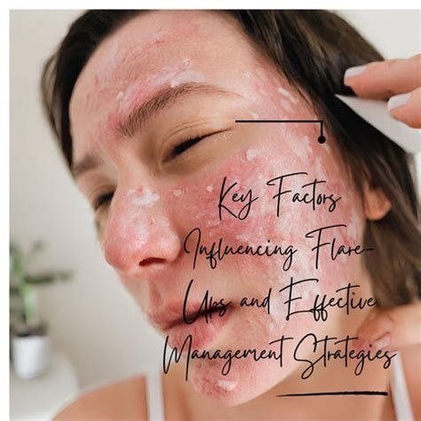 Managing Eczema and Psoriasis: Expert Strategies for Flare-Up Relief | Clinikally