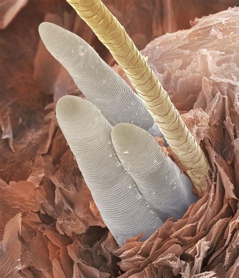eyelash mites | Microscopic photography, Things under a microscope, Micro photography