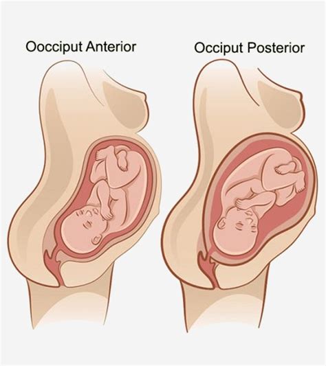 Fetal Position & Presentation: Guide To Expecting Mothers