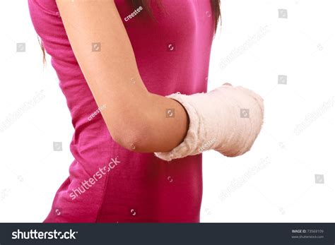 Broken Hand In Cast Of A Young Female Stock Photo 73569109 : Shutterstock