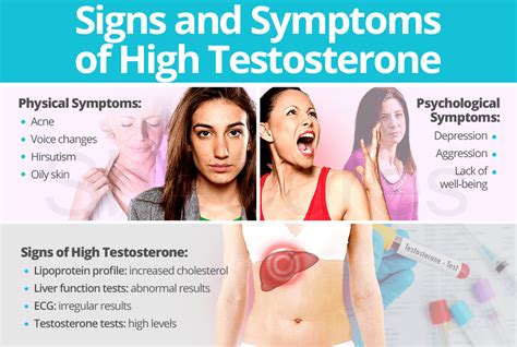 Signs and Symptoms of High Testosterone | SheCares