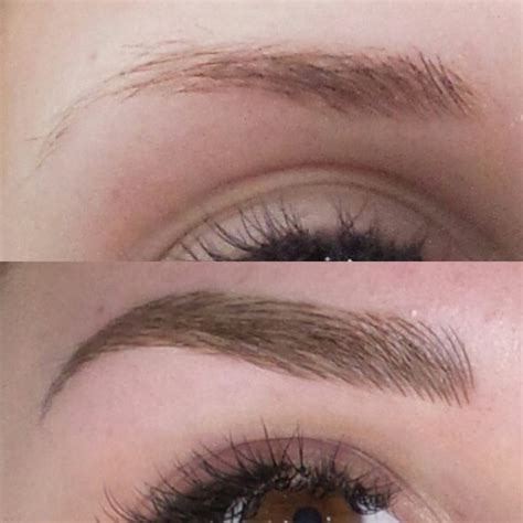 Sol Cosmedics Eyebrow Microblading