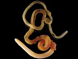 Simple worms are closet brainiacs | Simple, Human evolution, Worms