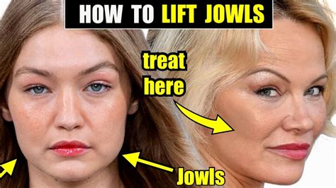 How to Lift & Tighten the Jowls with Sculptra-FDA Proven to Tighten ...