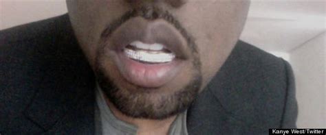 Kanye West's Diamond Teeth: Is He Embarrassed By His Dental Decision ...