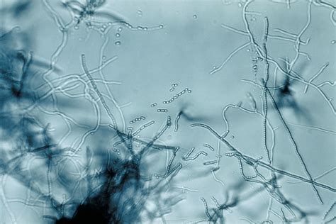 Improved annotation of Streptomyces RefSeq genomes - NCBI Insights