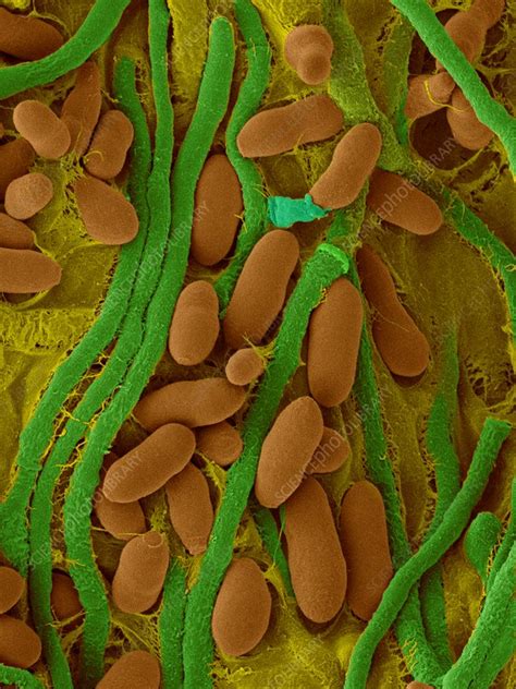 Fungus Acremonium stromaticum, SEM - Stock Image - C032/2961 - Science Photo Library