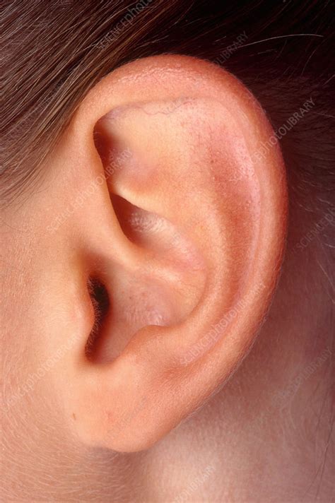 Teenage Girl's Ear - Stock Image - C003/4333 - Science Photo Library