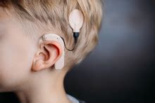 Cochlear Implant Free Stock Photo - Public Domain Pictures