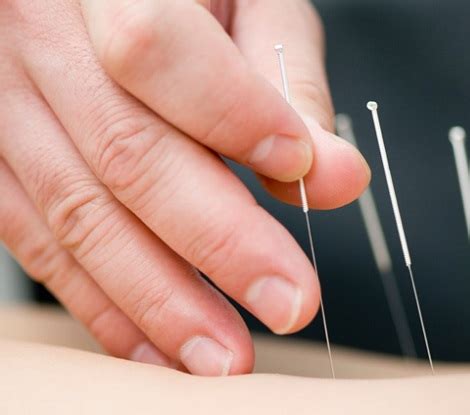 Acupuncture For Pain - Back Pain, Neck Pain, Knee Pain, Shoulder Pain