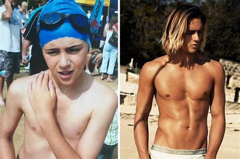 How to get ripped: Bullied teen with congenital deformity reveals how ...