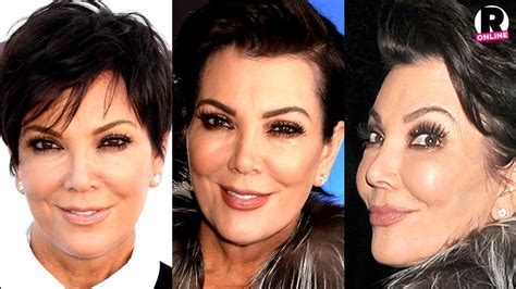 Plastic Fantastic! Surgeon Claims Kris Jenner Used Botox, Injections ...