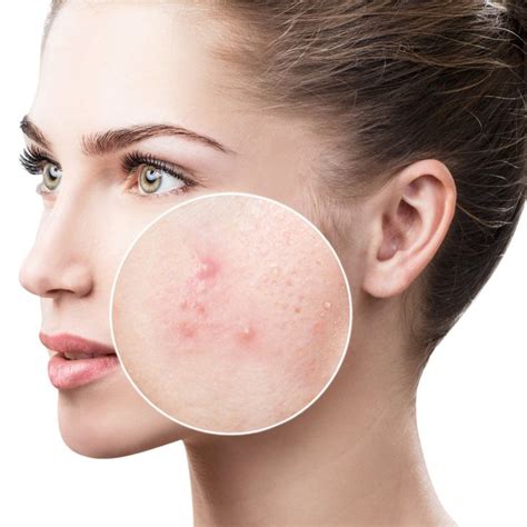 Dermatologists in Clearwater FL | Clear Skin Dermatology