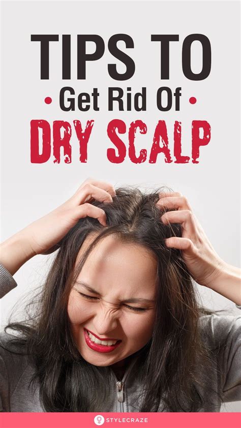 10 Best Home Remedies To Get Rid Of Dry Scalp in 2020 | Dry scalp, Dry ...