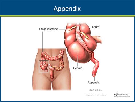 Appendicitis Nursing Care Management: Study Guide