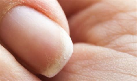 This DIY Remedy Will Fix Your Dull, Brittle Nails | TipHero