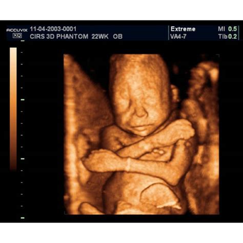 Fetal Ultrasound Training Phantom 20 Weeks CIRS 065-20