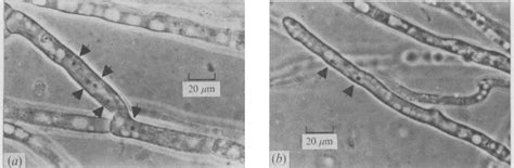 Comparison of typical homokaryotic and heterokaryotic cells of A ...