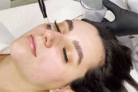 Know the best: Dermabrasion vs Microdermabrasion - Age