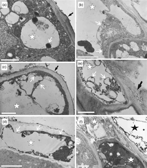 TEM micrographs showing the ultrastructure of protodermal (a, c, d, f ...