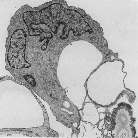 (PDF) Structure and function of podocytes: An update