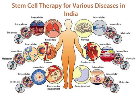 Best Stem Cell Therapy — Stem Cell Cure | by Stem Cell Cure | Stem Cell ...