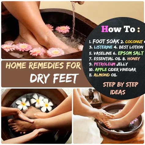 #11 Smooth & Soft Feet: How to Get Rid of Dry Feet - Home Remedies ...