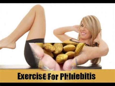 6 Home Remedies For Phlebitis - YouTube