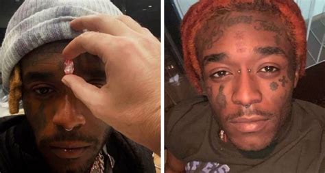 Rapper Lil Uzi Vert Shares Video Of $24 Million Pink Diamond Implanted In His Forehead