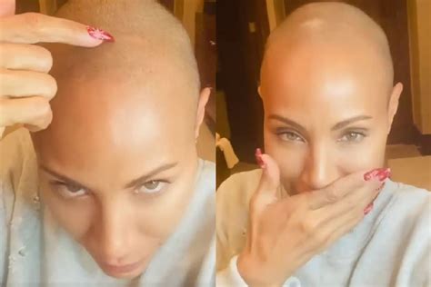 Jada Pinkett Smith shares struggle with alopecia.