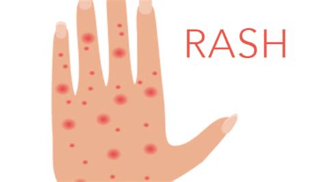 Side Effect of Chemotherapy: Skin Rash - CancerConnect