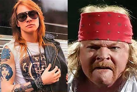 Axl Rose Then And Now Eye-Opening Photos