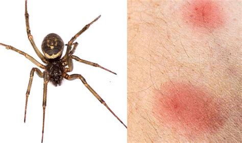 What Does A Hobo Spider Bite Look Like At First : zoology - Spider Identification: Is this an ...