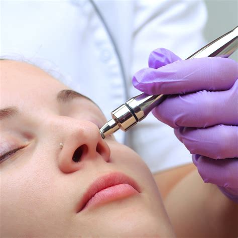 Unlocking Youthful Skin: The Power of Microdermabrasion for Anti-Aging and Acne Treatment ...