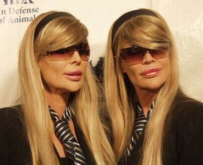 Barbi Twins Plastic Surgery Facelift and Chin Implants Before an After ...