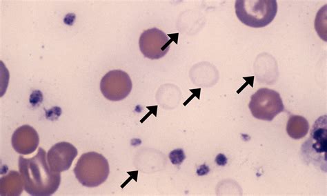 Ghost Cells – Cells and Smears