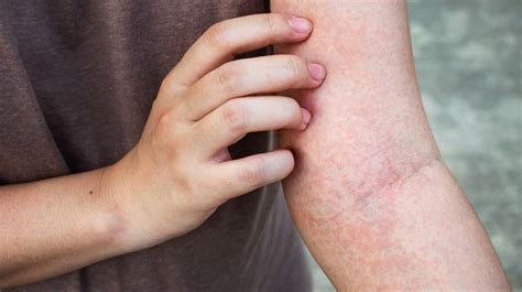 If Your Skin Is Often Itchy Or Inflamed, You Should Check Out This ...