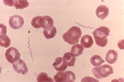 VETERINARY HEMATOLOGY DEXTERVET: Borrelia burgdorferi (Lyme Disease) Spirochaetaceae