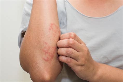 Understanding the Causes of Dry Skin Rash and Effective Remedies - Elxr Health