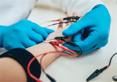 Electromyography & Nerve Conduction