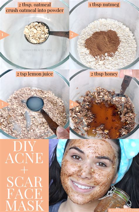 23 Best Diy Face Mask for Acne Scars - Home, Family, Style and Art Ideas