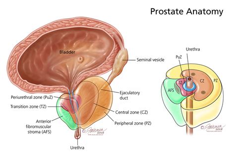 Prostatitis (Infection of the Prostate): Symptoms, Diagnosis & Treatment - Urology Care Foundation