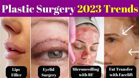 5 Plastic Surgery Trends for 2023 - YouTube