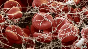 Noticias de Salud: Cholesterol drugs could cut clots
