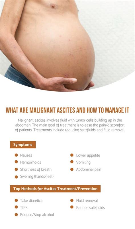 What Is Malignant Ascites And How To Manage It - Fatty Liver Disease