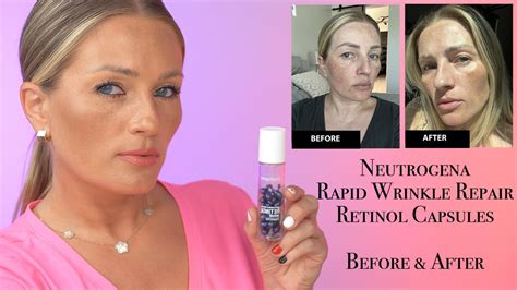 Neutrogena Rapid Wrinkle Repair Retinol Capsules | Before and After Pictures - YouTube