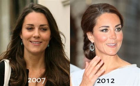 Kate Middleton Nose Shape