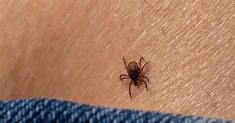 Spider Mite Bites on Humans: Symptoms and Treatment